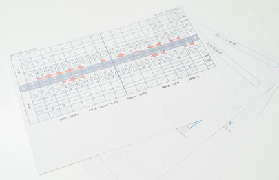 見て分かる歯周病のリスク「プロービングチャート」